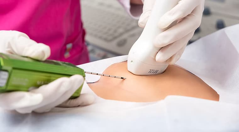 Toma de biopsias